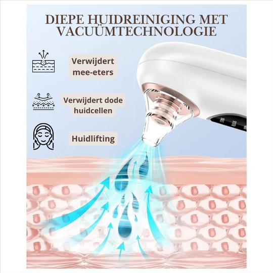 Vacuüm Poriënreiniger