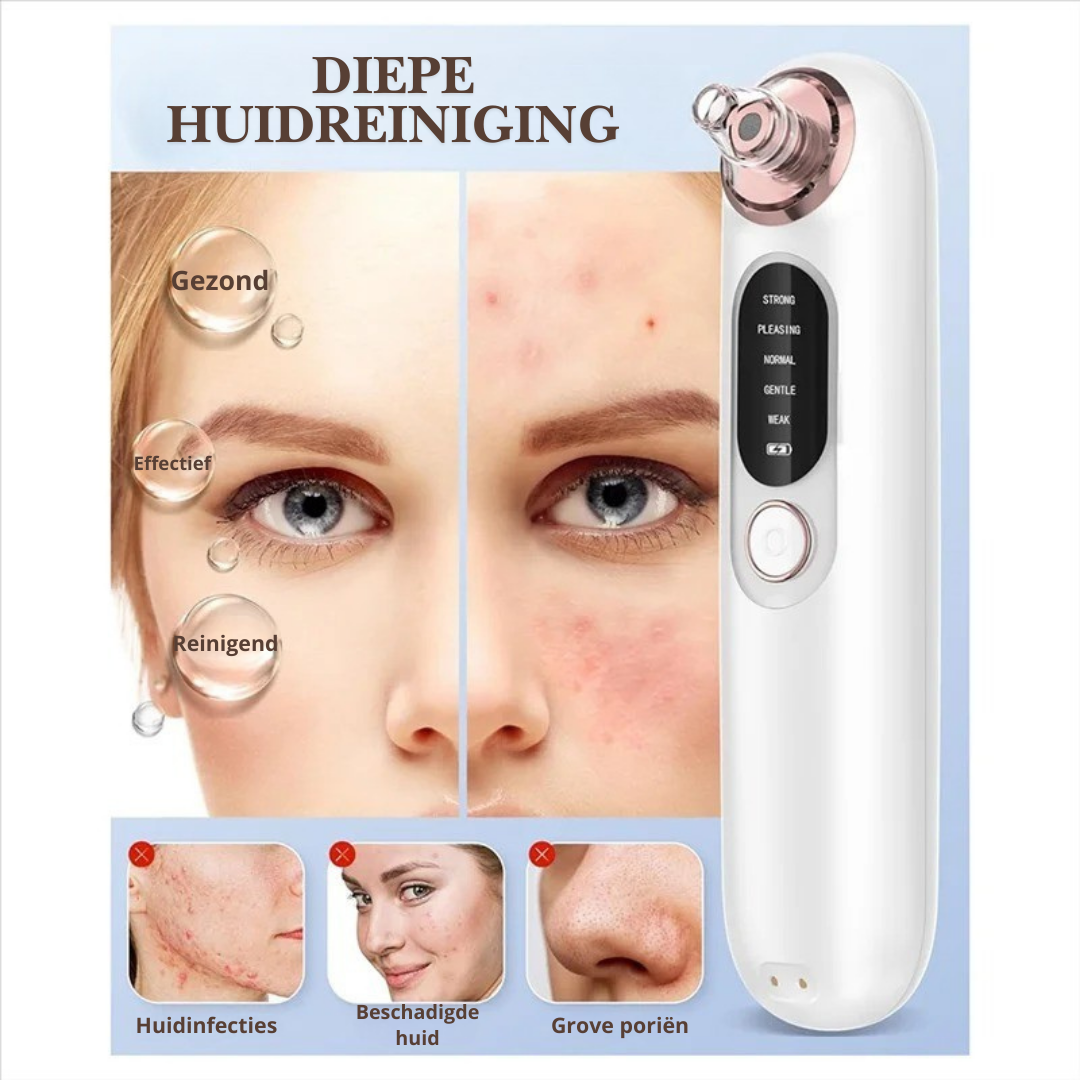 Vacuüm Poriënreiniger